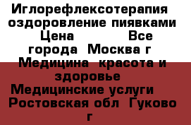 Иглорефлексотерапия, оздоровление пиявками › Цена ­ 3 000 - Все города, Москва г. Медицина, красота и здоровье » Медицинские услуги   . Ростовская обл.,Гуково г.